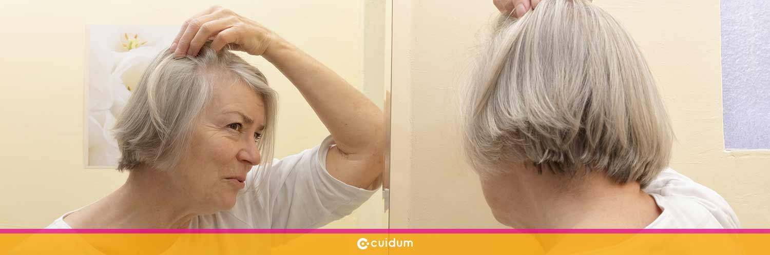 pérdida de cabello en personas mayores